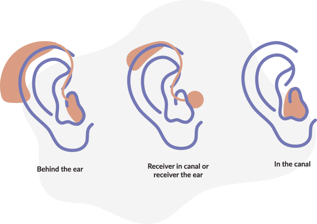 Types of Hearing Aids