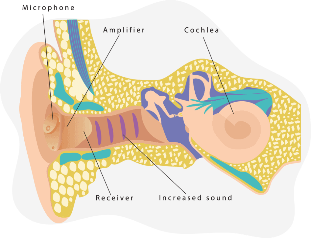 Hearing Diagram